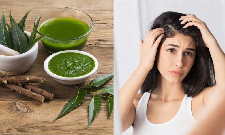 Neem for Dandruff A natural remedy to get rid of it.
