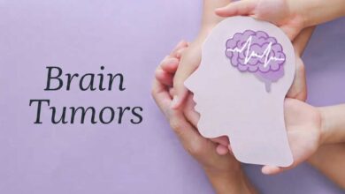 What are the different types of brain tumors
